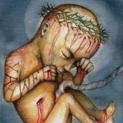 El horrible crimen del aborto